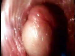 Cumshotti presents: Video from the inside of a vagina... very interesting